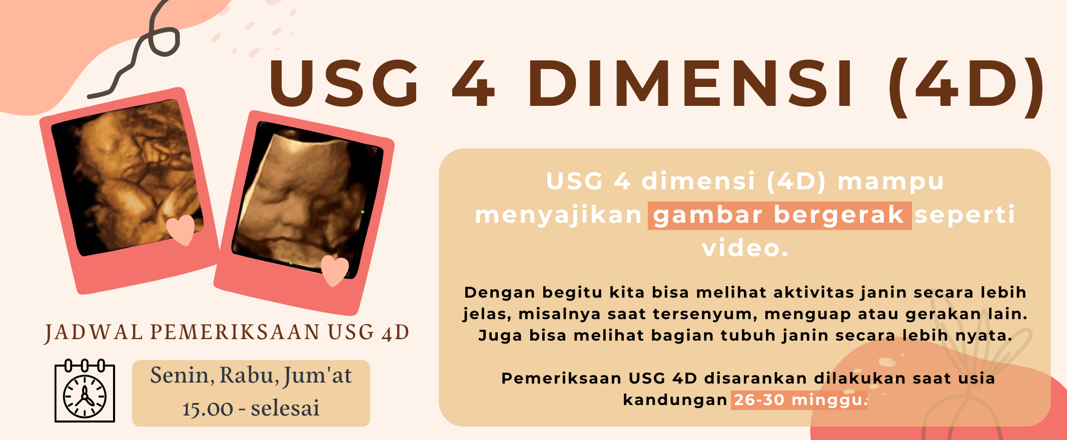 slide four - usg 4d